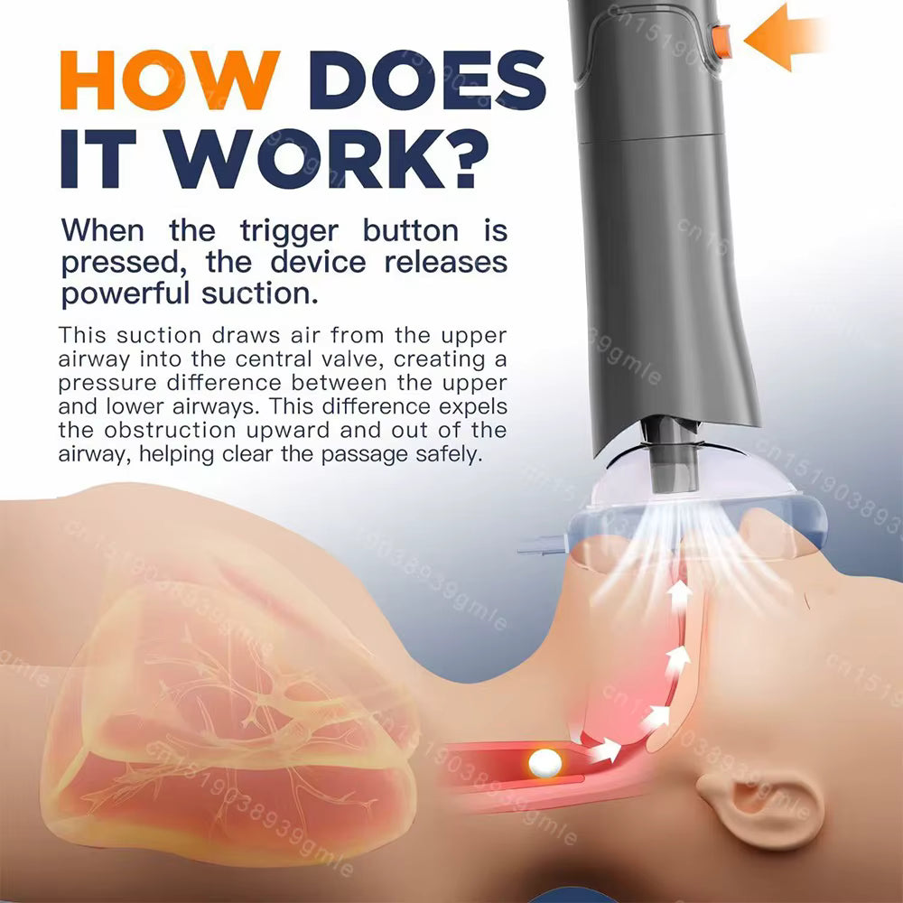 EmeraSafe™ Anti-Choking Device – Emergency Airway Protection